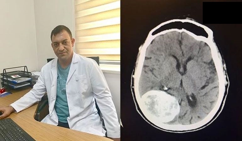 Akşehir Devlet Hastanesi’nde Beyin Tümörü Ameliyatlarında Büyük Başarı